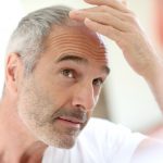 Senior man and hair loss issue